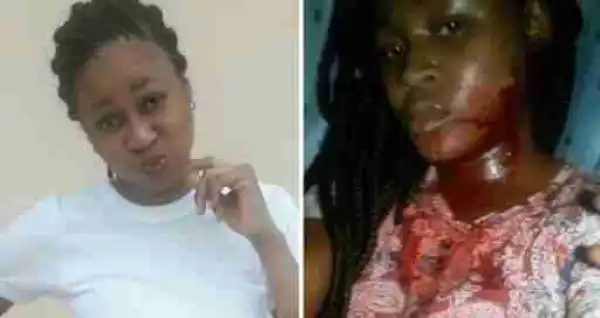 Pretty NOUN Student Stabbed In The Face By Hostel Mate, Lands In Hospital (Graphic)